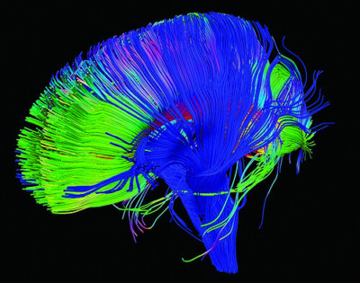 effect of trauma on brain