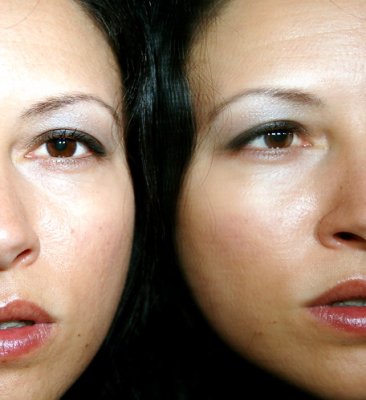 body dysmorphic disorder